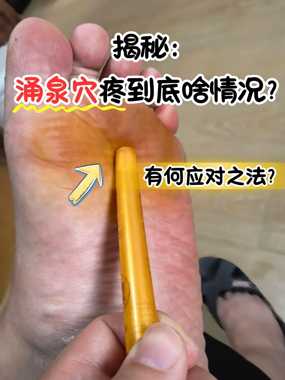 艾灸涌泉的禁忌有哪些