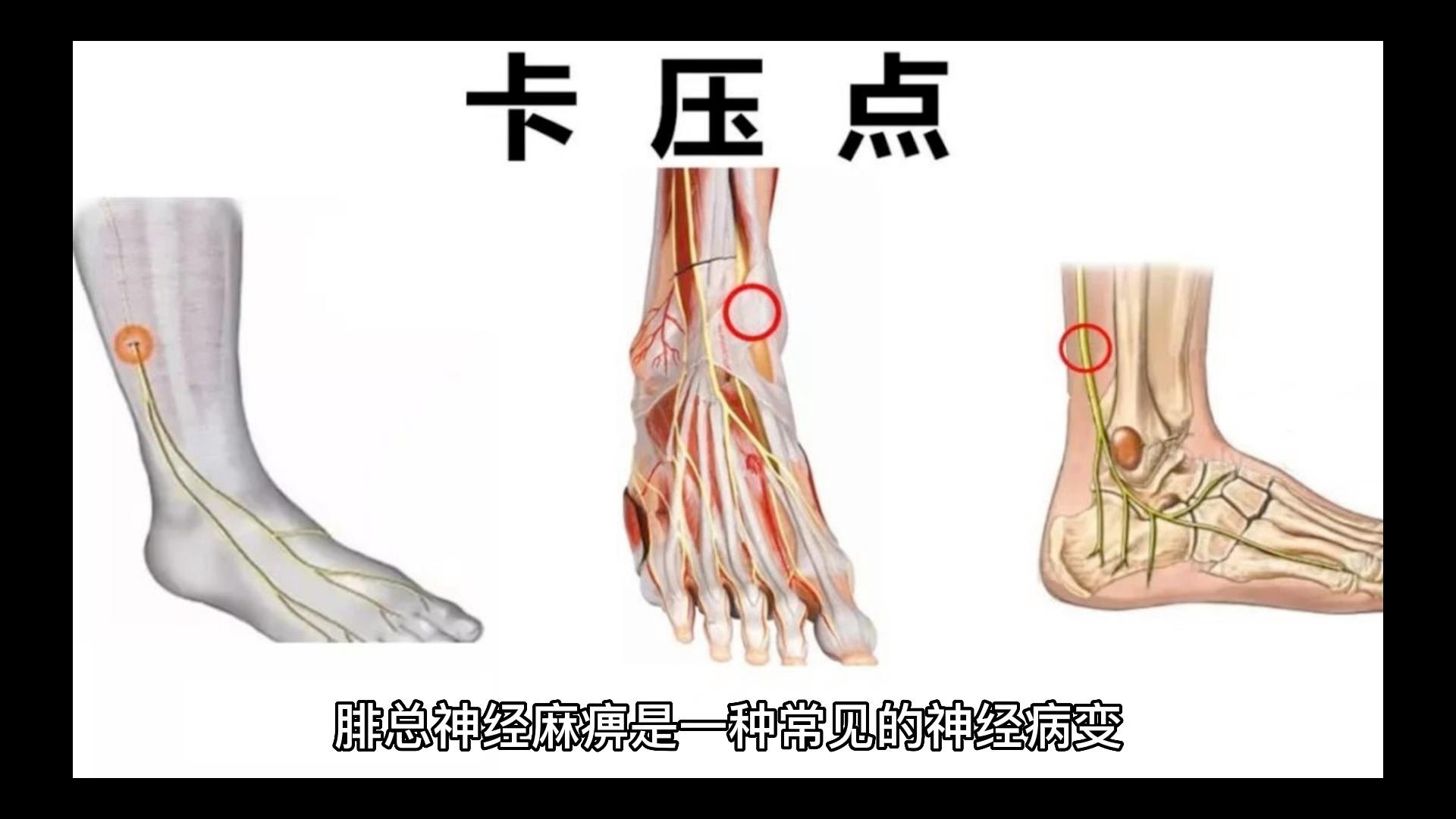 腓总神经的作用是什么?