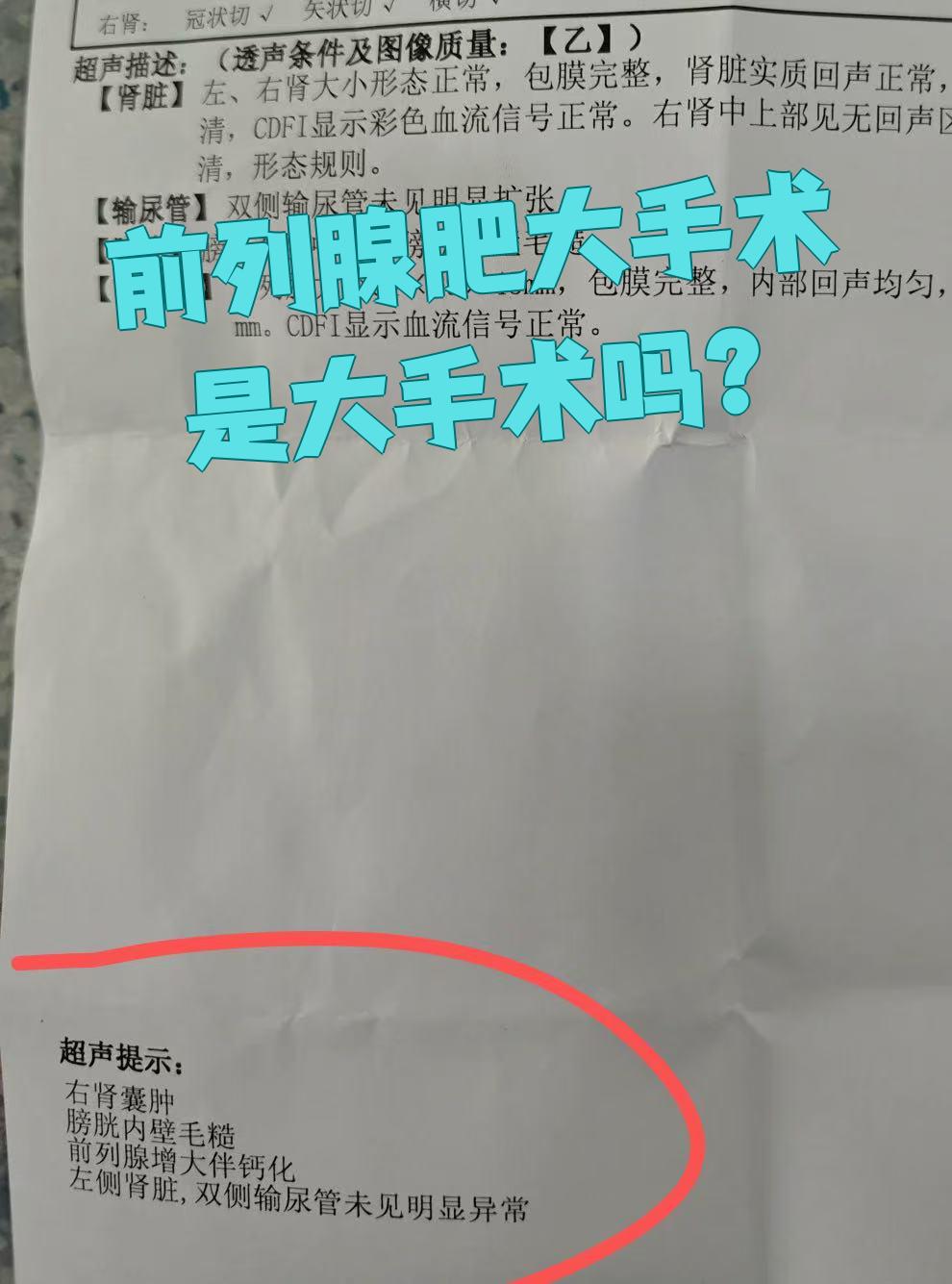 前列腺可以切除吗