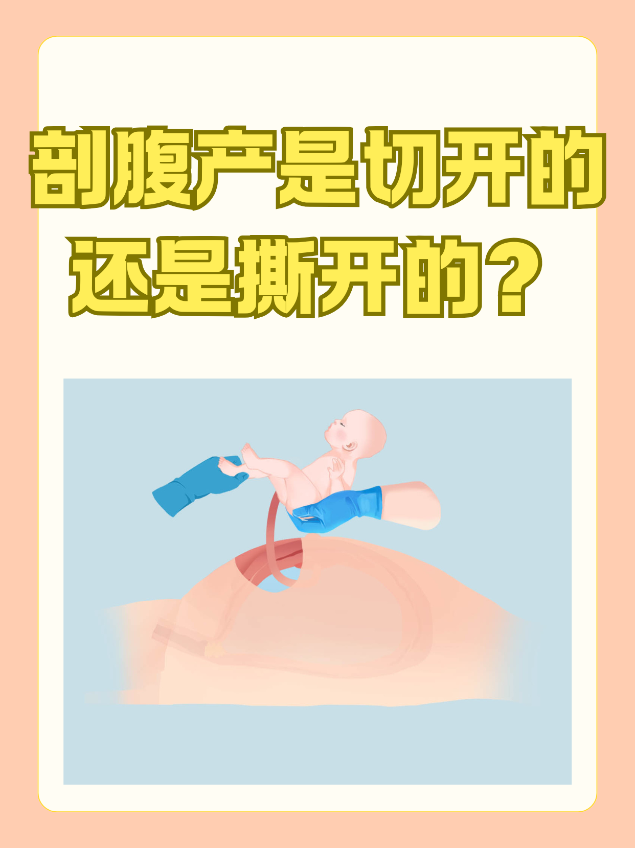 多少周就可以刨腹产