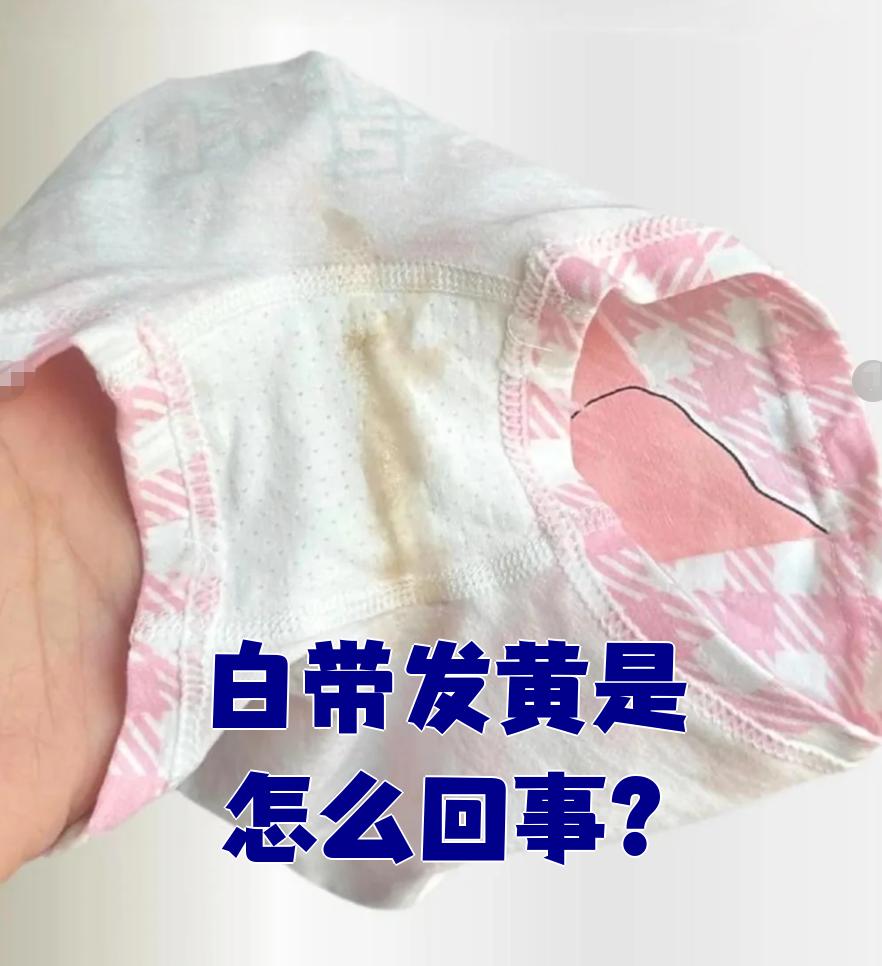 白带偏黄怎么回事