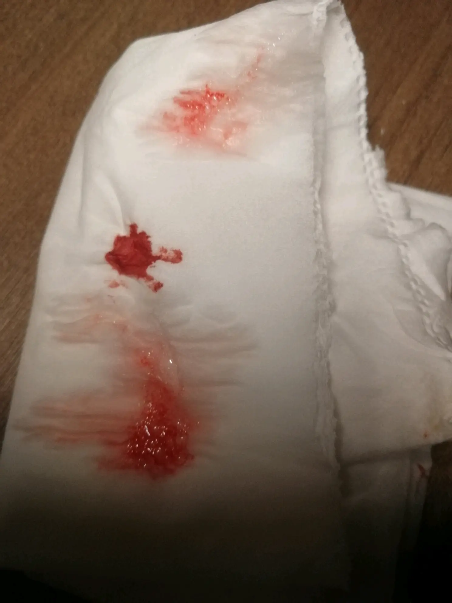 早上起来咳嗽痰中带血