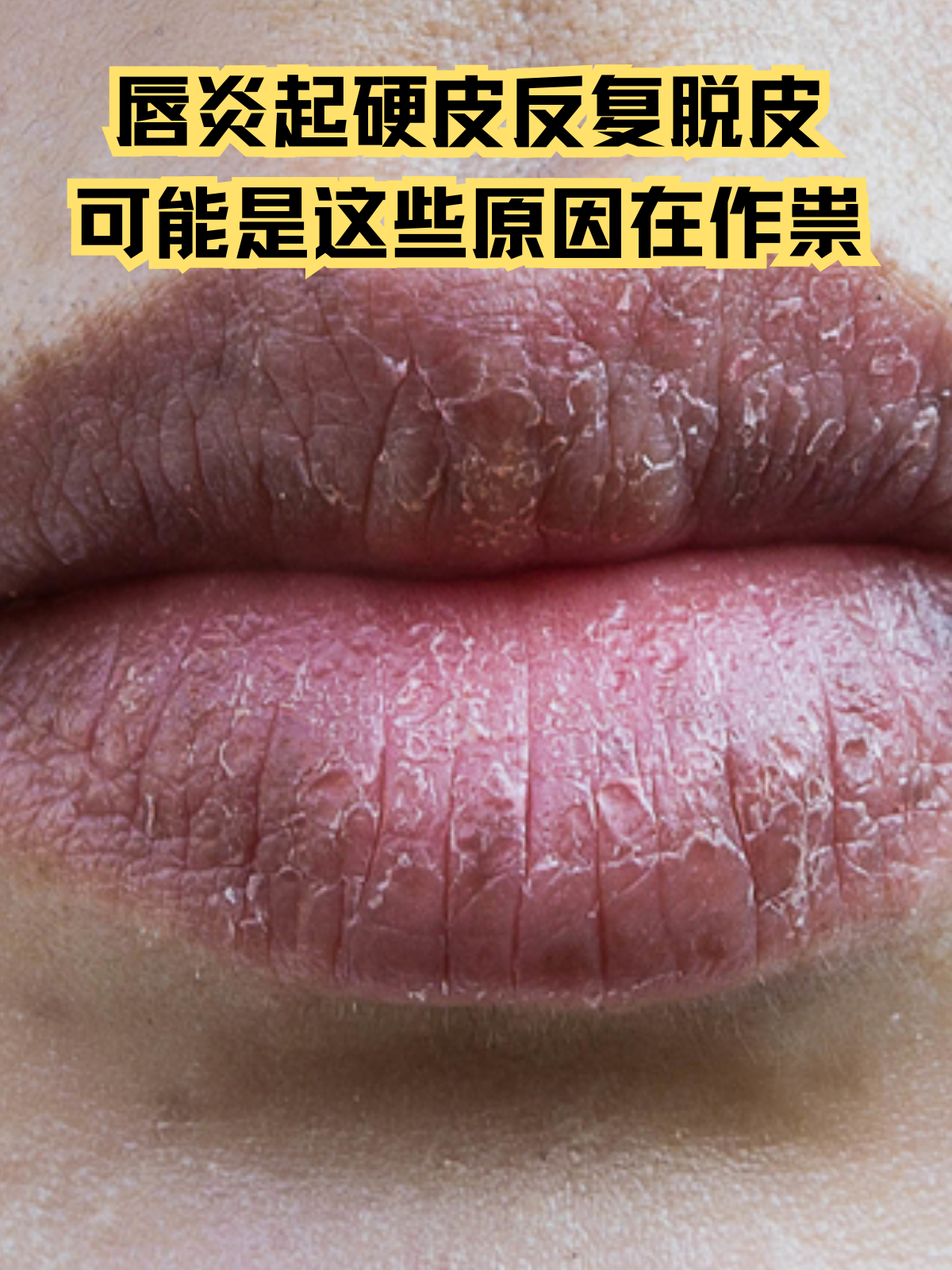 嘴唇发麻是什么原因