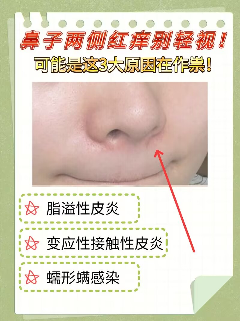 鼻子痒是怎么回事??