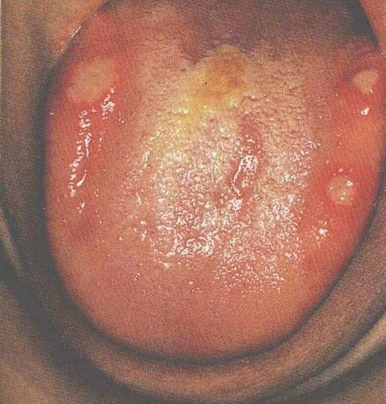 什么是病毒性皮肤病?