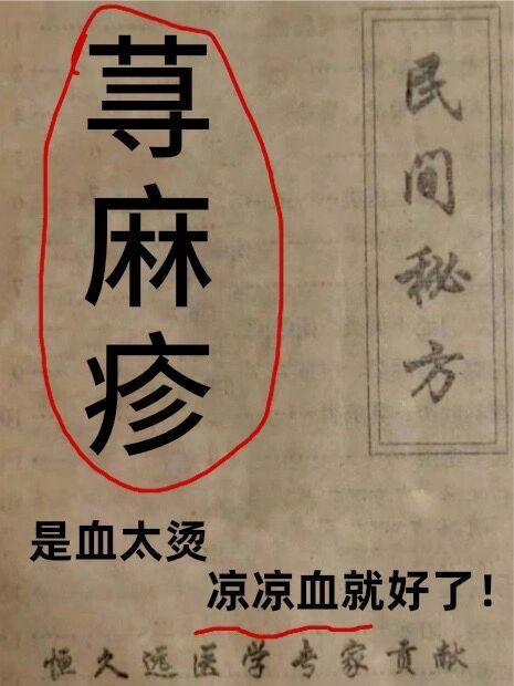 荨麻疹药方