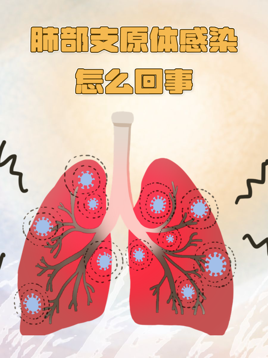 肺炎支原体感染