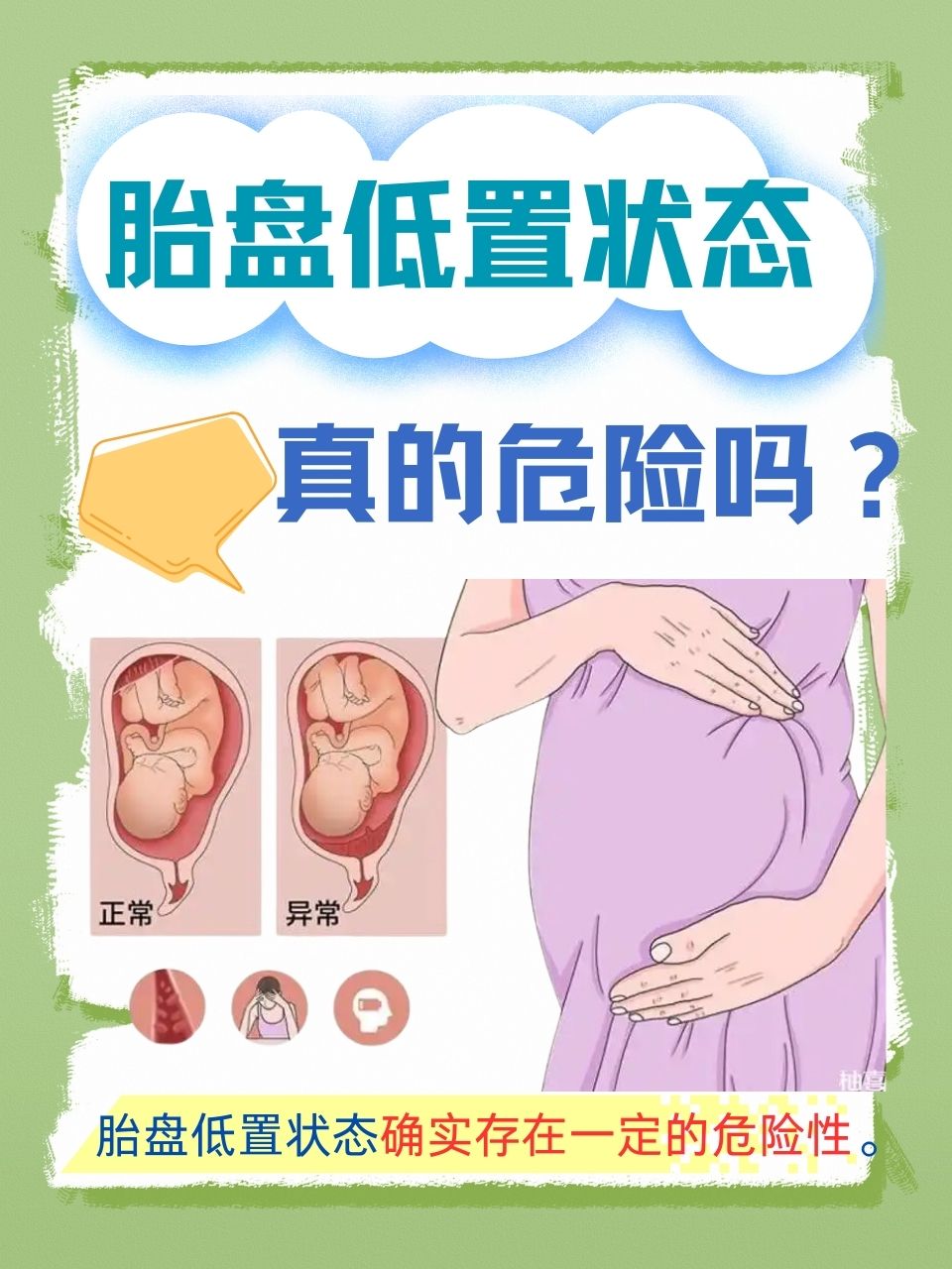 胎盘植入有哪些症状