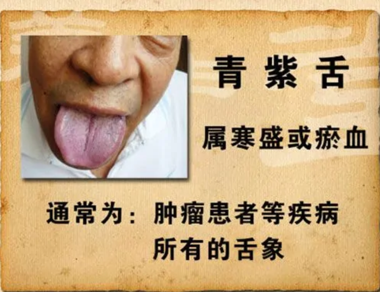 舌头发紫是怎么回事?