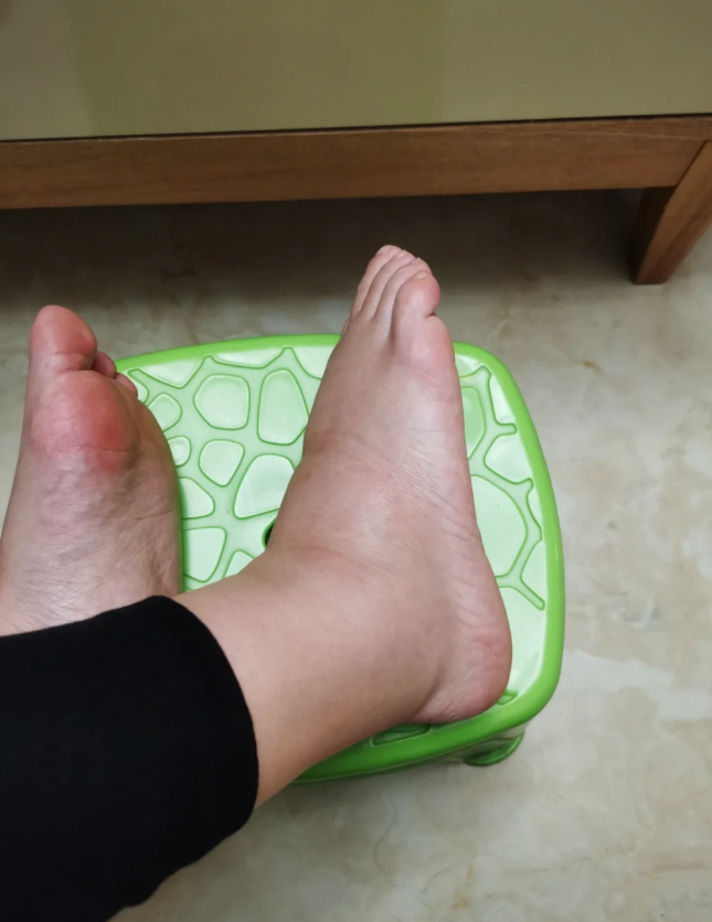 坐久了脚肿是什么原因