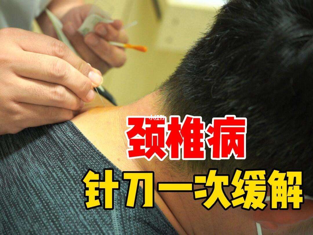 针刀疗法有副作用吗?