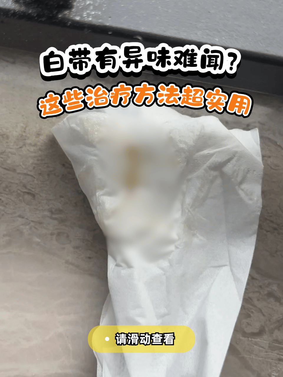 白带异常有异味怎么办