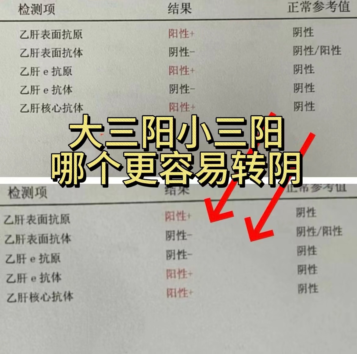 乙肝大三阳治疗有几种方法?