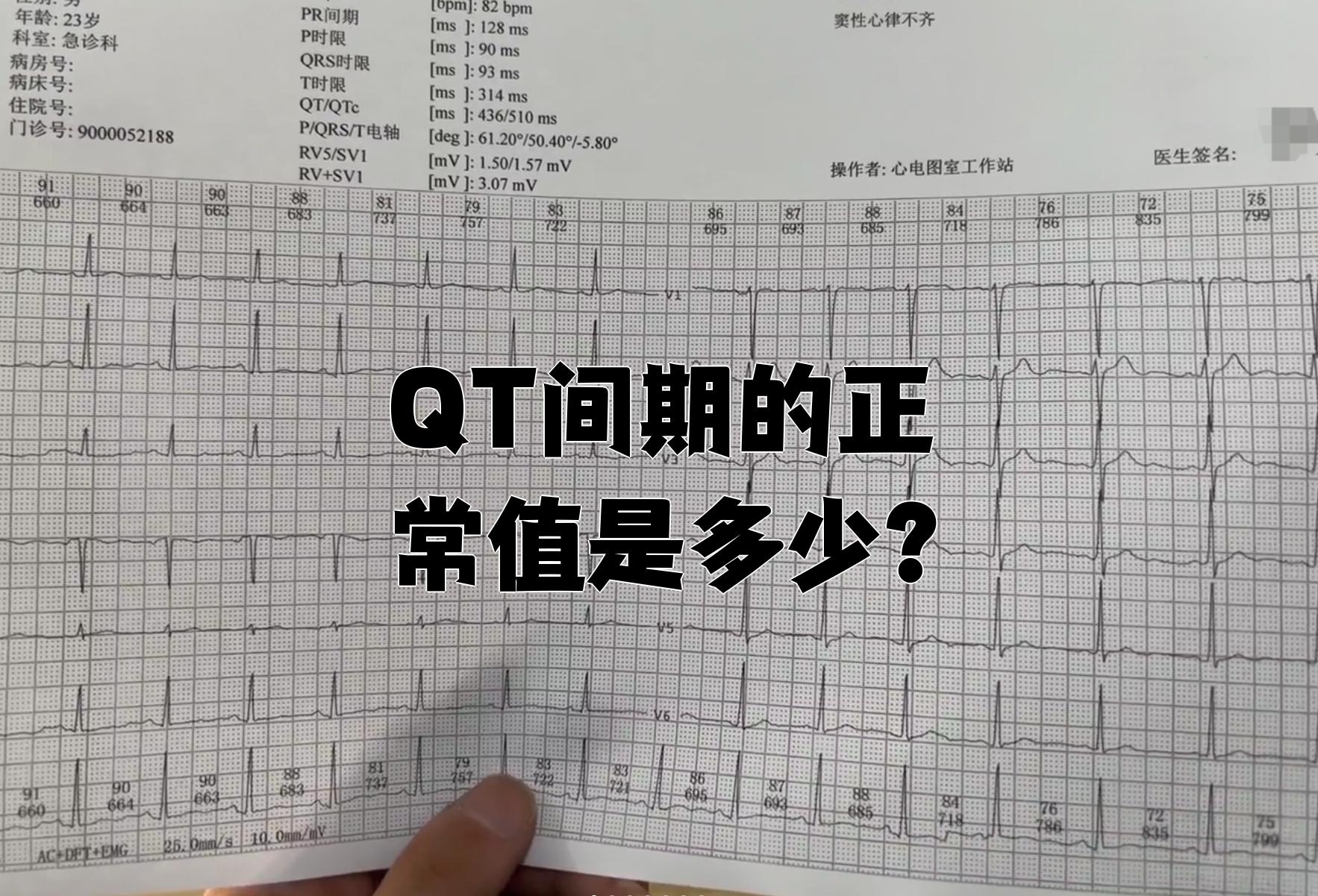 人正常的心率是多少