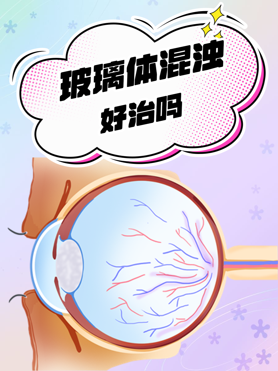 眼底玻璃体混浊的原因