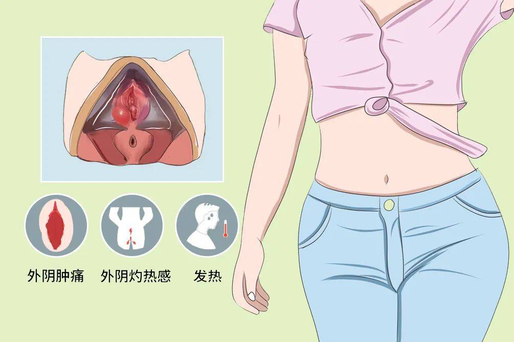 什么是阴道前庭?