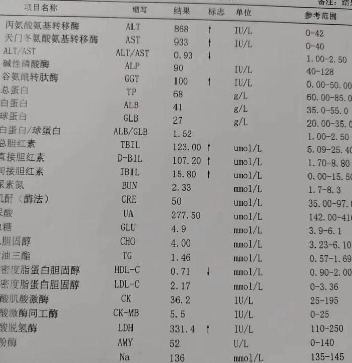 铁蛋白高怎么回事
