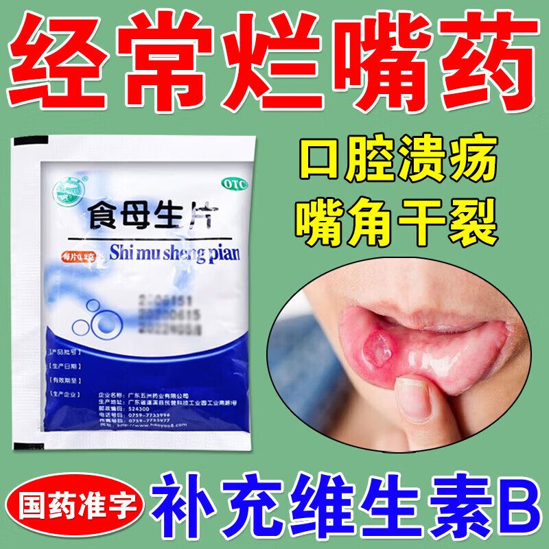 小儿口腔疱疹吃什么药