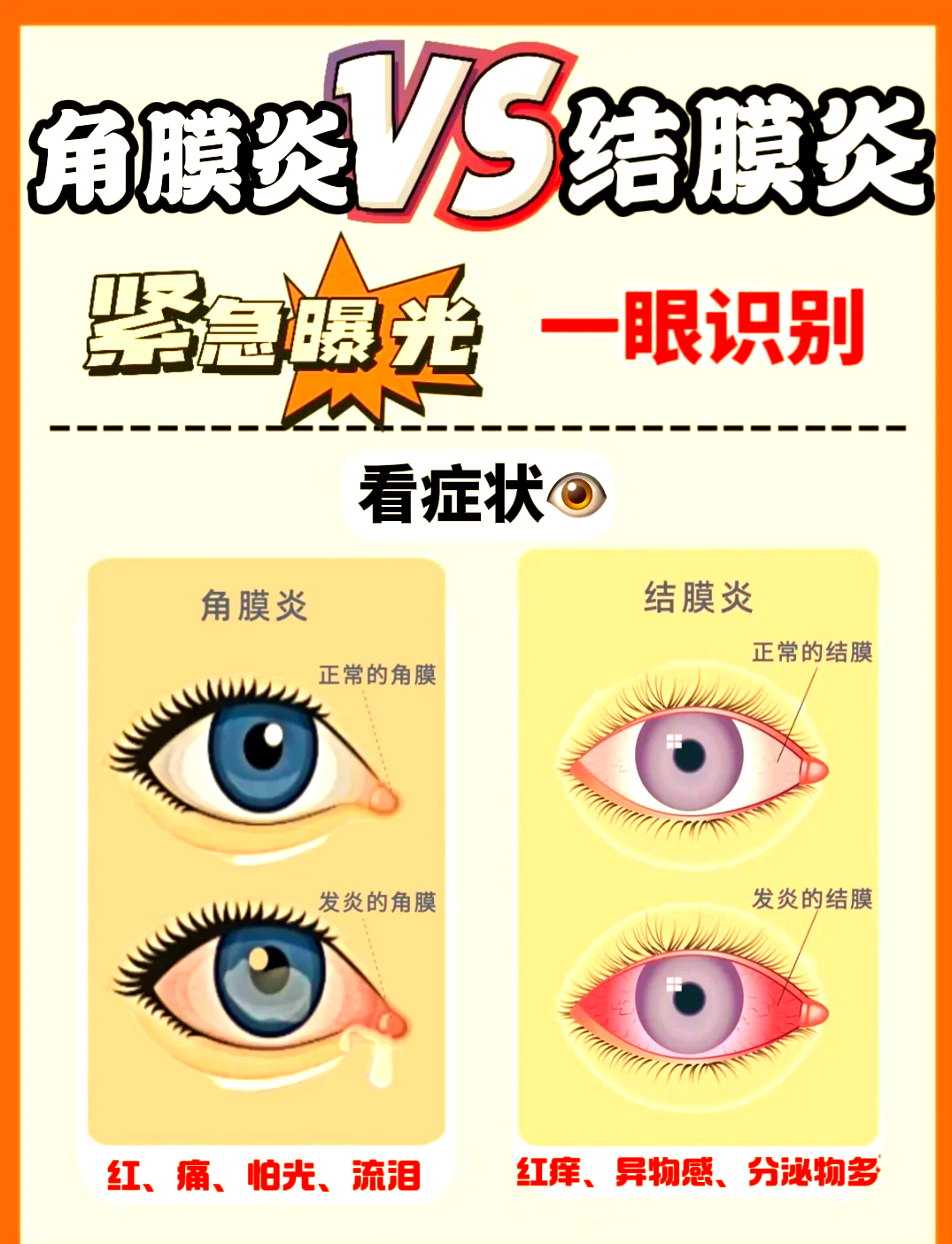角膜炎是由什么原因引起的