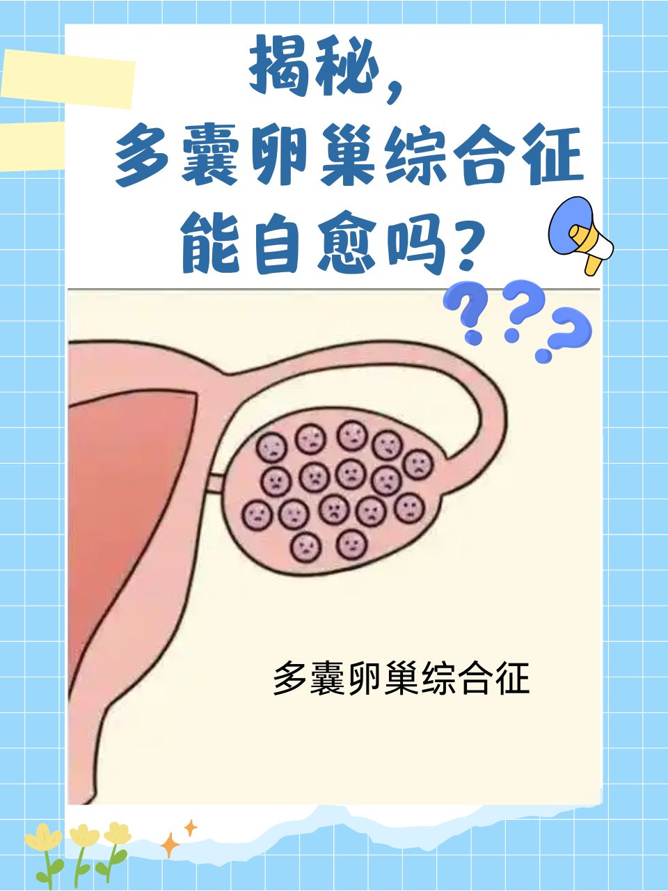 卵巢多囊是怎么形成的