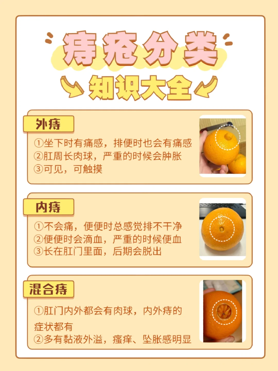 痔疮肉球怎么消除?