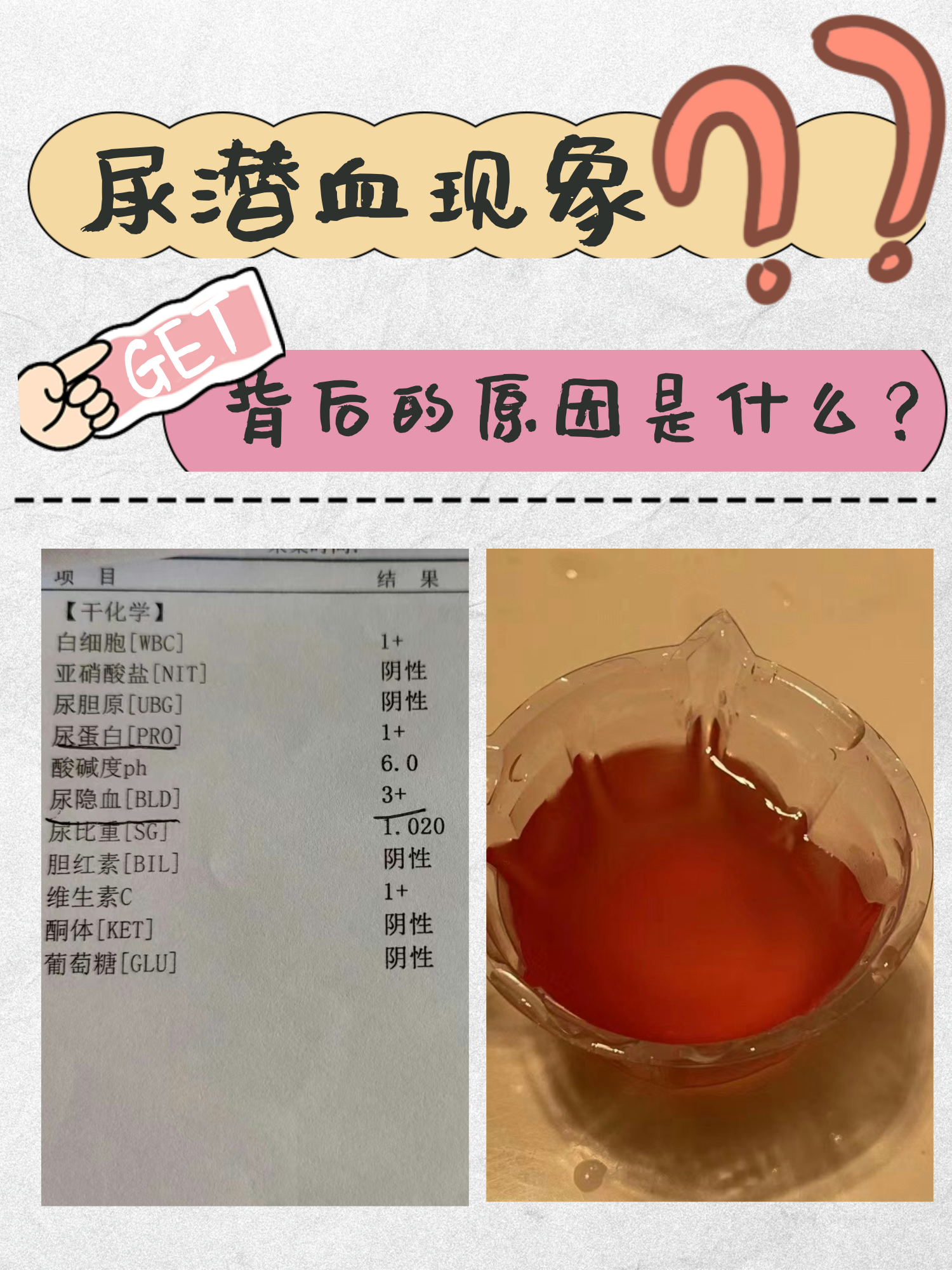 大便潜血阴性什么意思