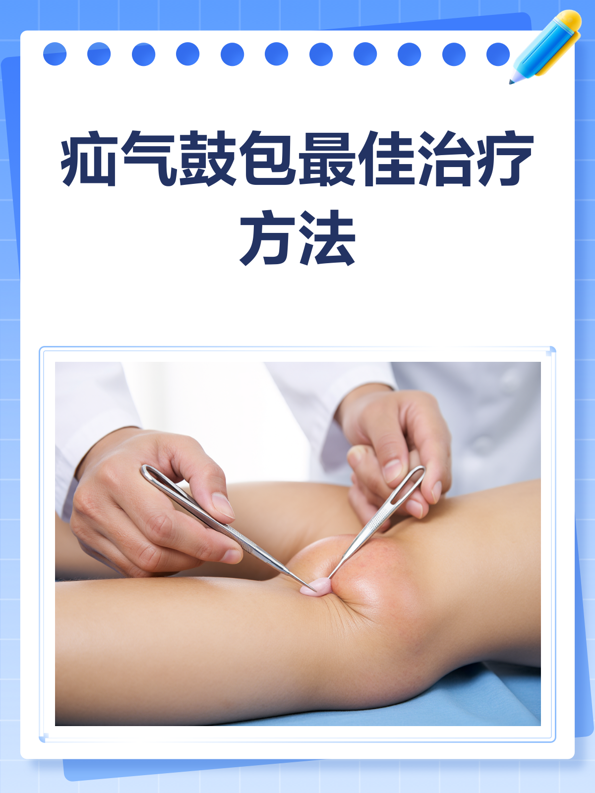 疝气,应该挂什么科?