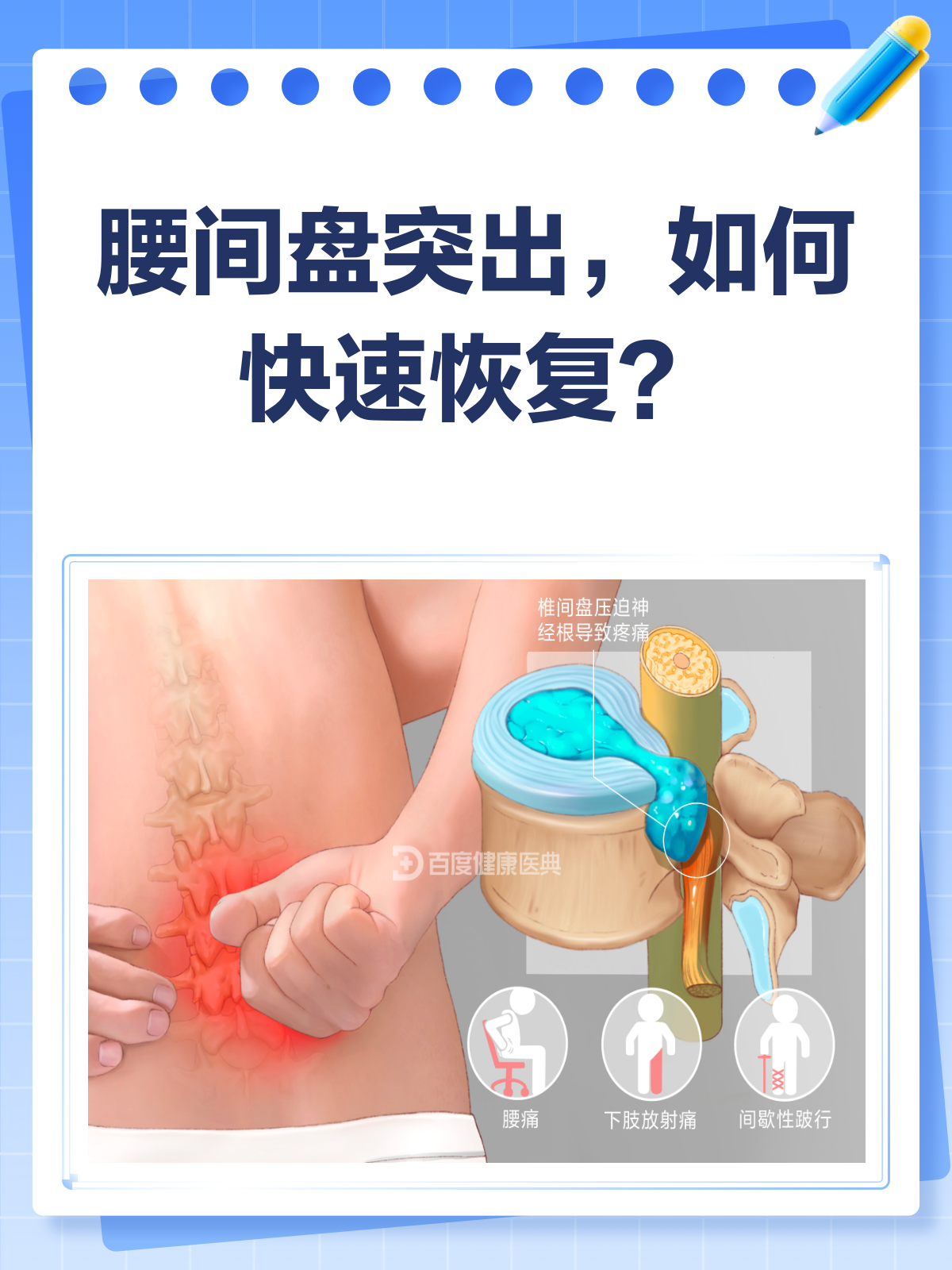 腰间盘突出能跑步吗