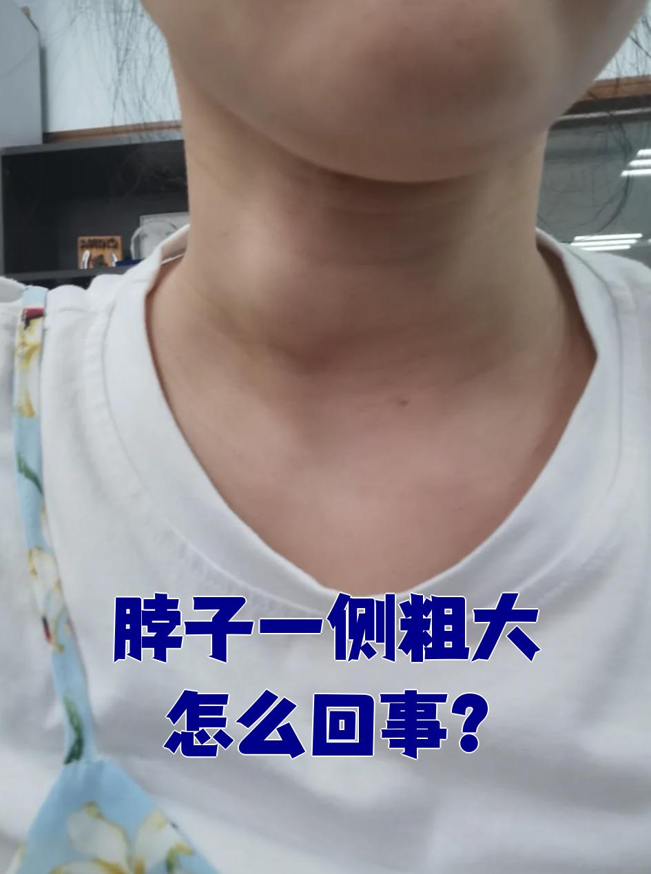 脖子粗是什么原因,感觉比别人大一些