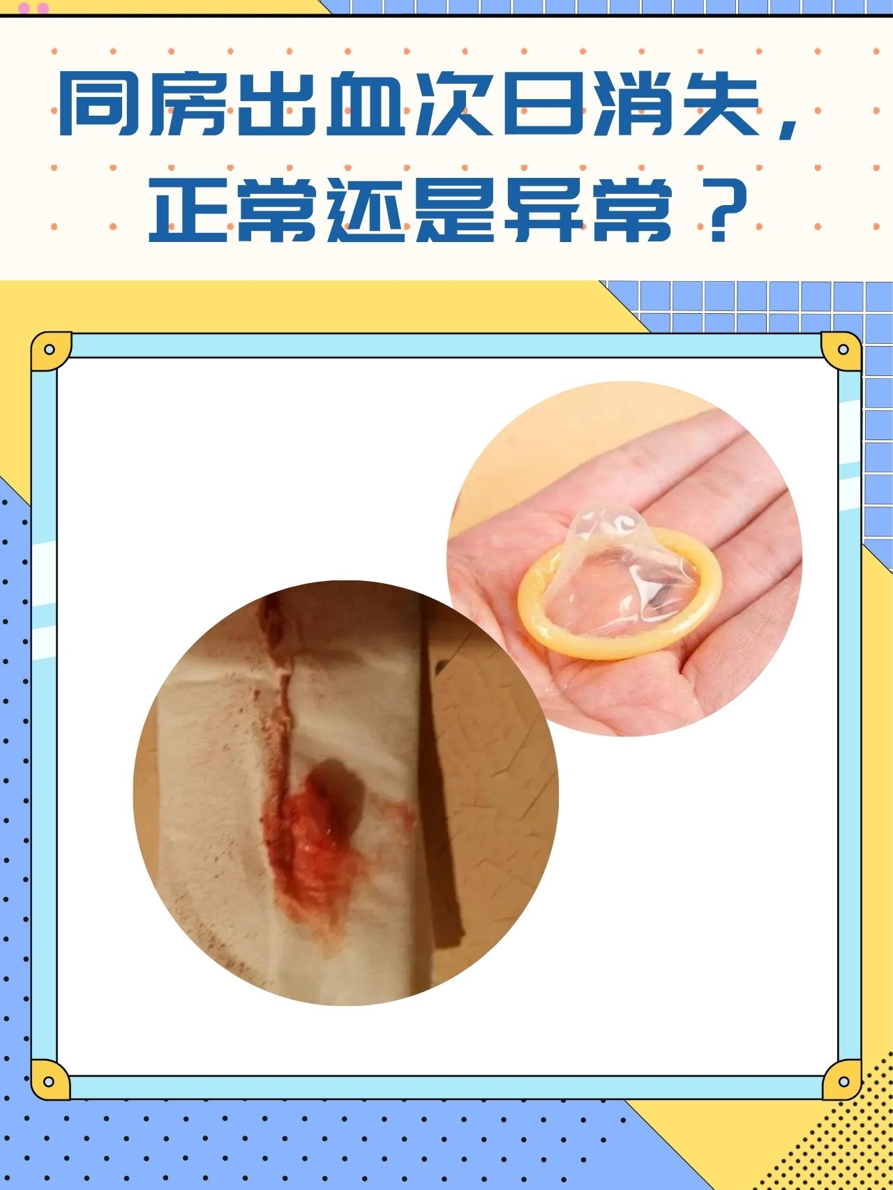 同房时流血是怎么回事