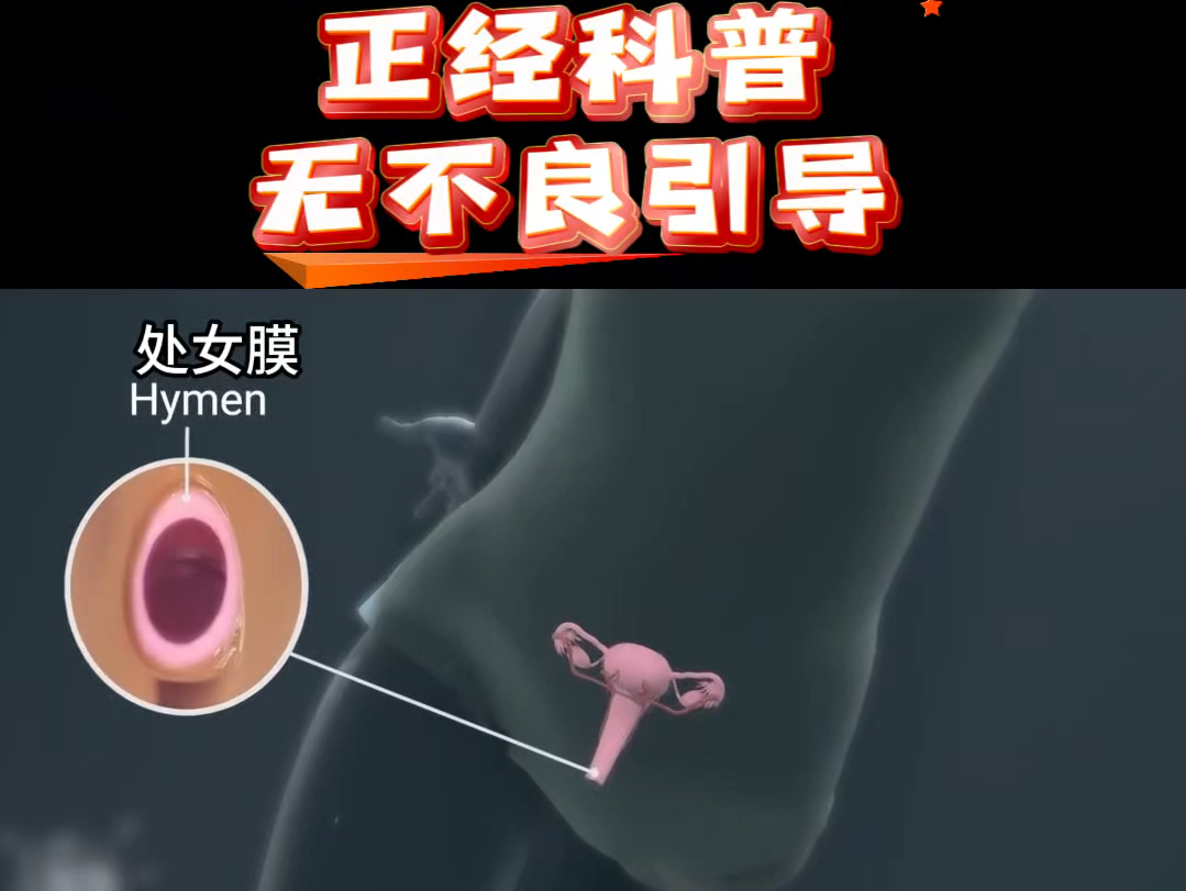 处女膜的位置