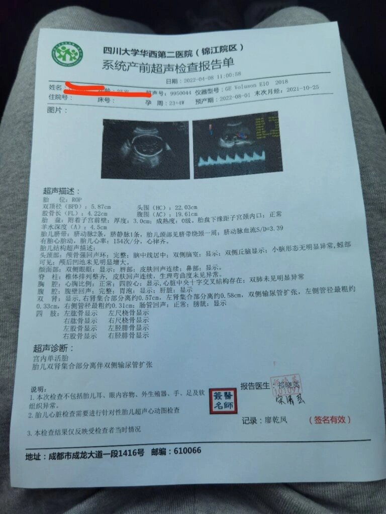 什么是肾盂分离?