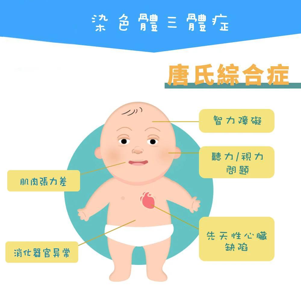 唐氏综合征筛查怎么做