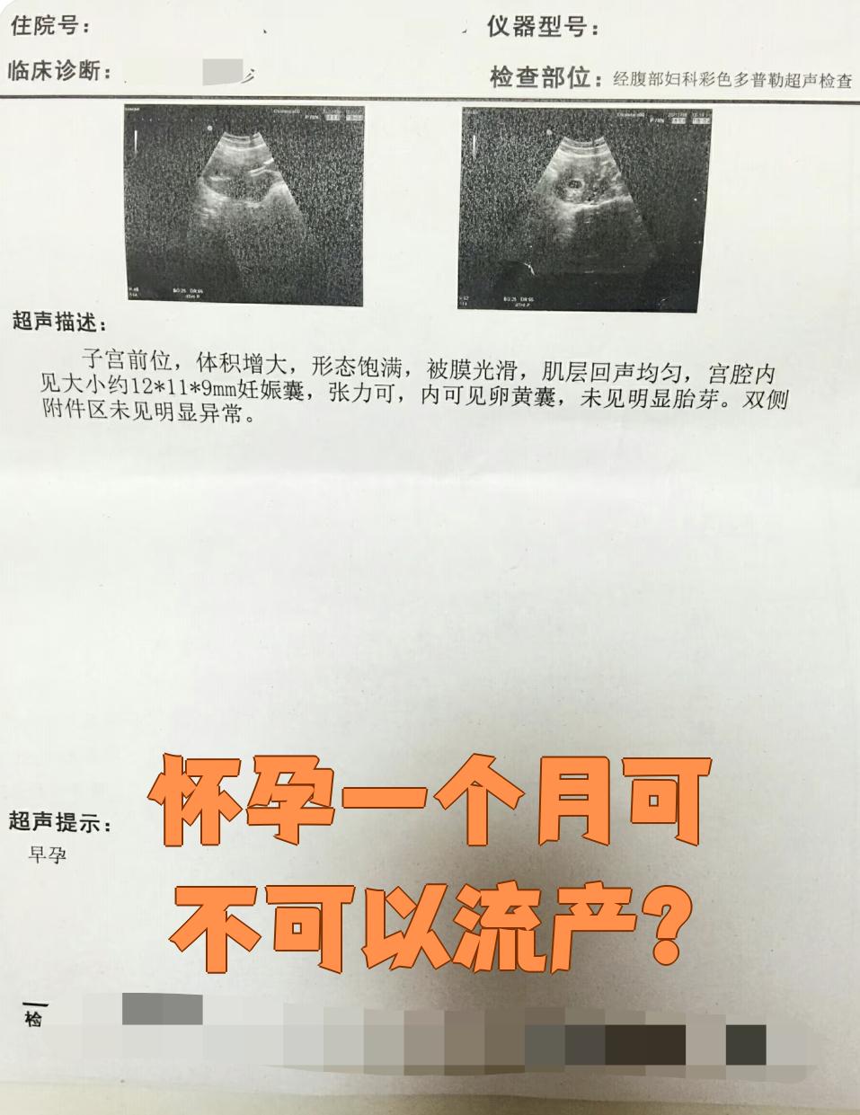 打过一次胎能怀孕吗?