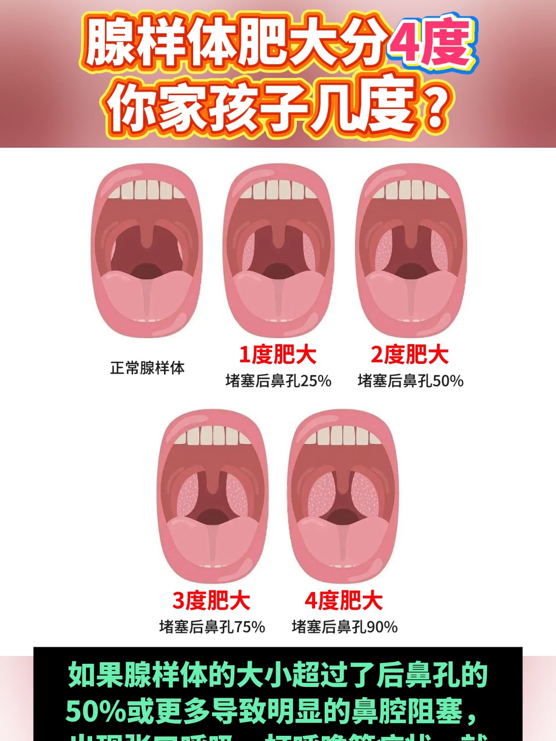 腺样体肥大能自愈吗