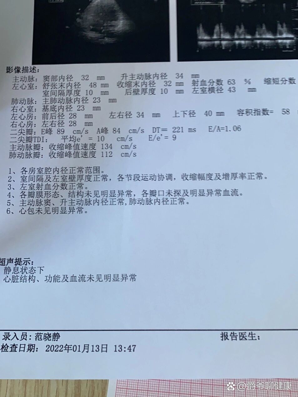 什么是心脏彩超?