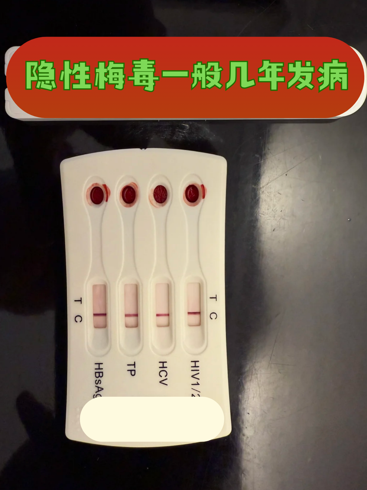 隐性梅毒会不会传染他人