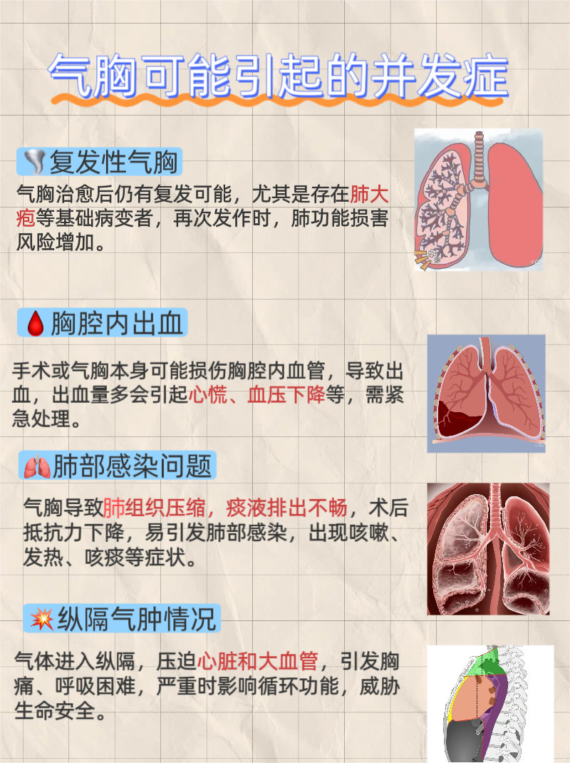 气胸严重吗?