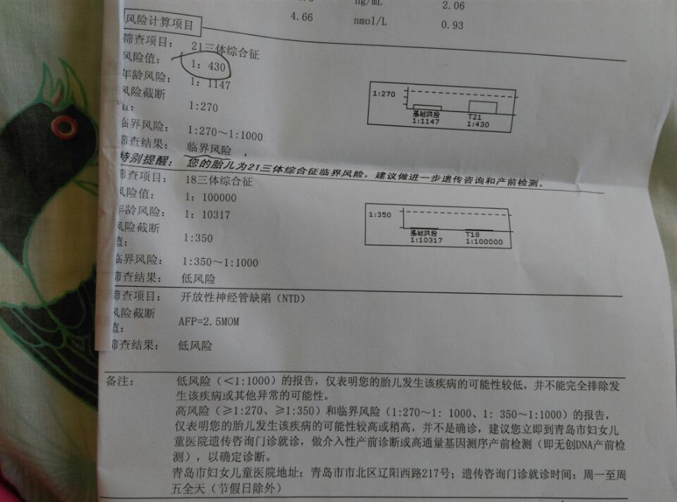 21三体综合征临界风险严重吗