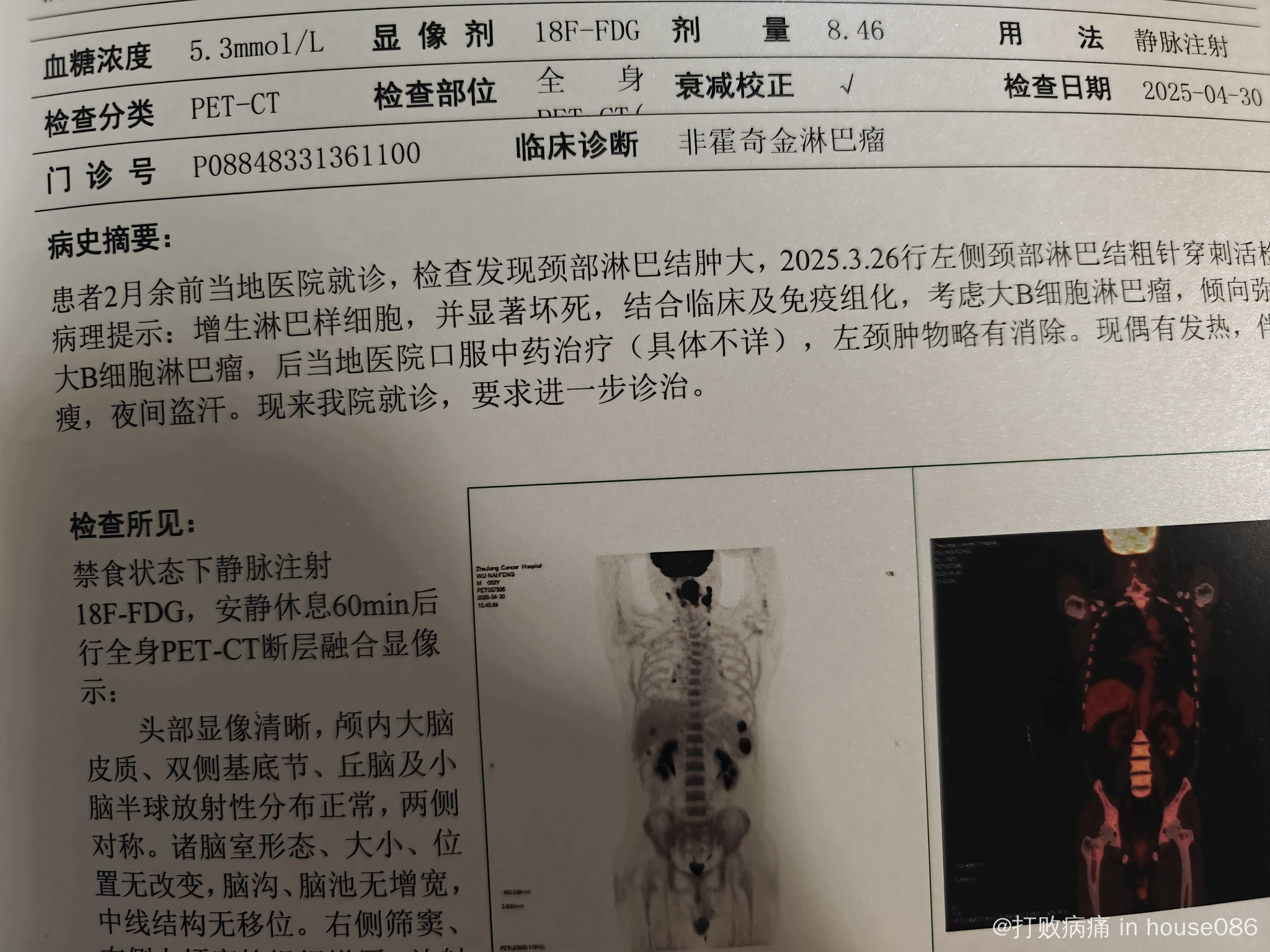petct检查医保报销吗