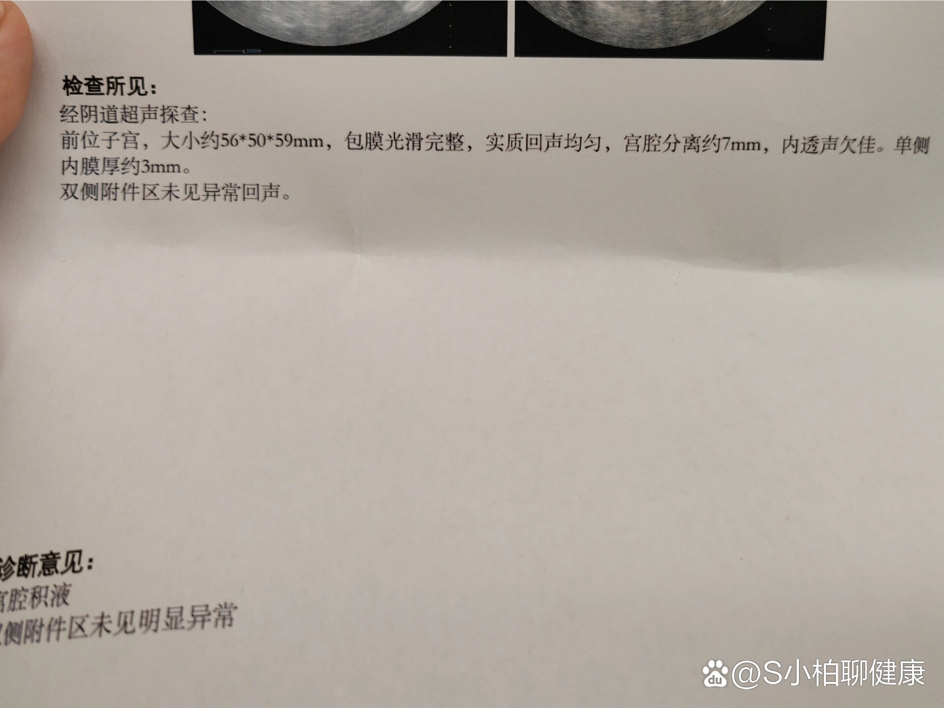 宫腔分离3mm要治疗吗