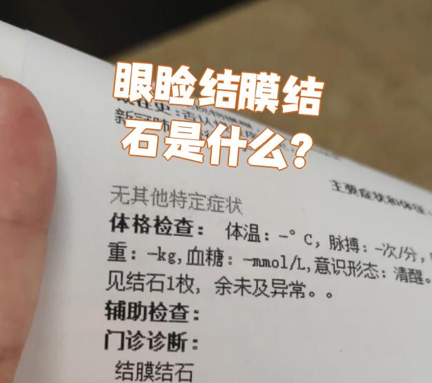 眼睑结石是怎么样形成的?