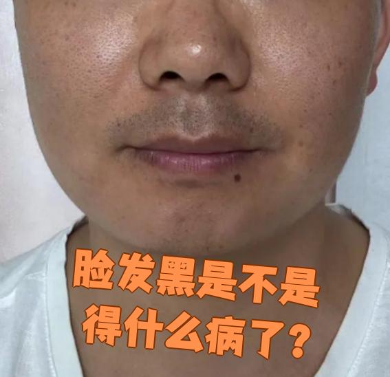 脸色发黑怎么回事?