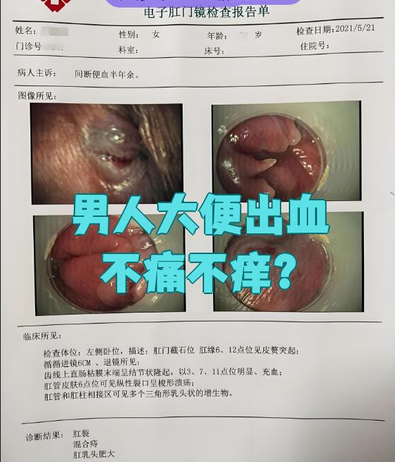 男生大便出血是怎么回事