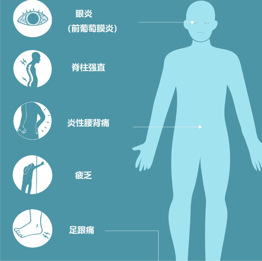 脊椎病的症状有哪些