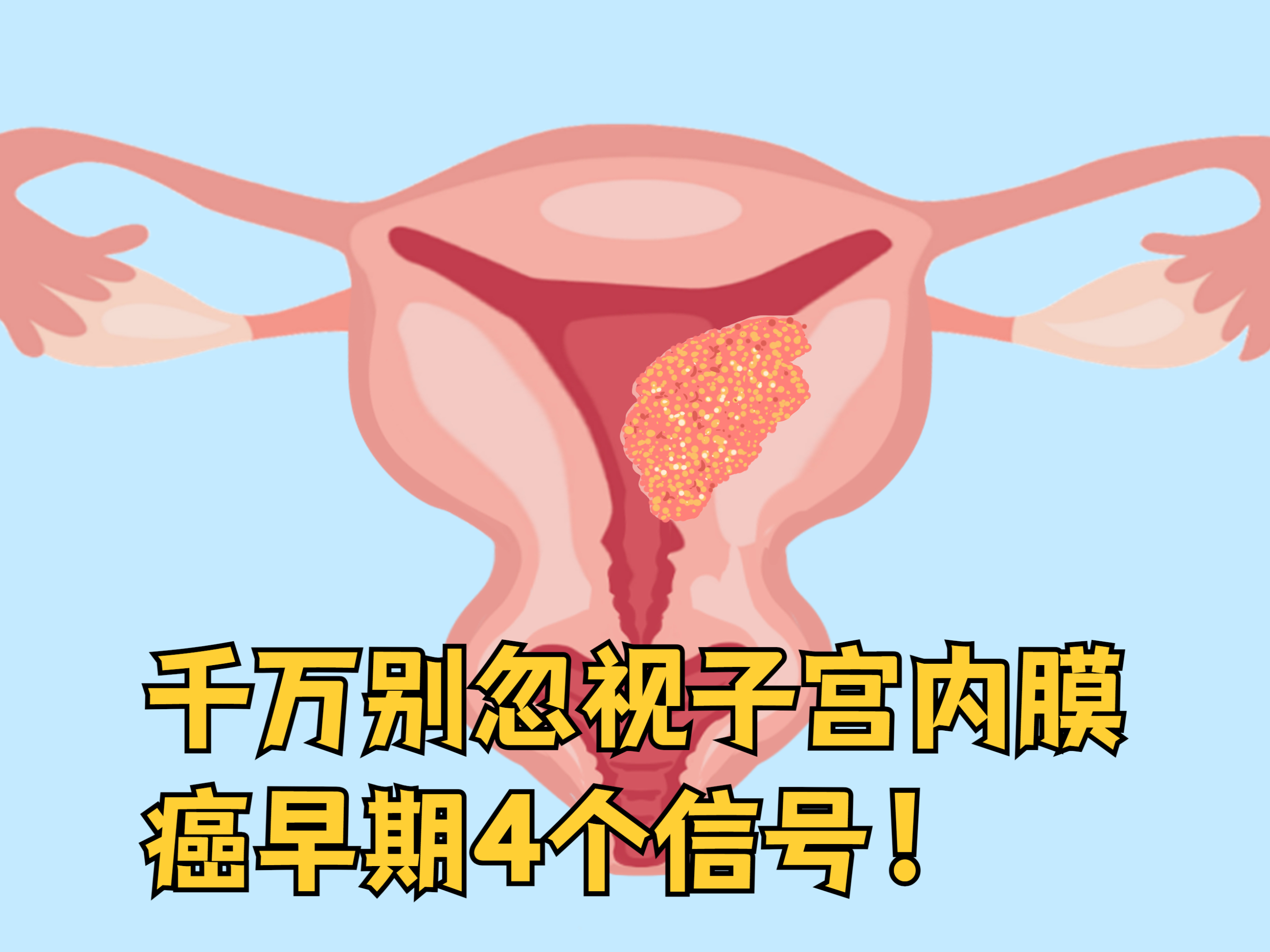 子宫内膜增厚能癌变吗