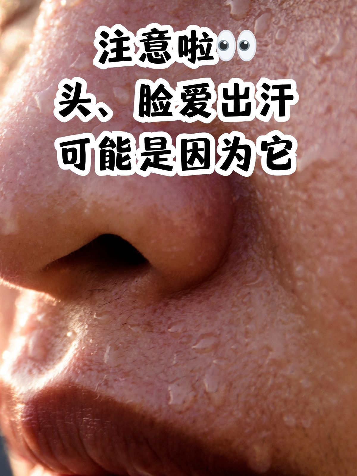 中年男人头部多汗是何原因