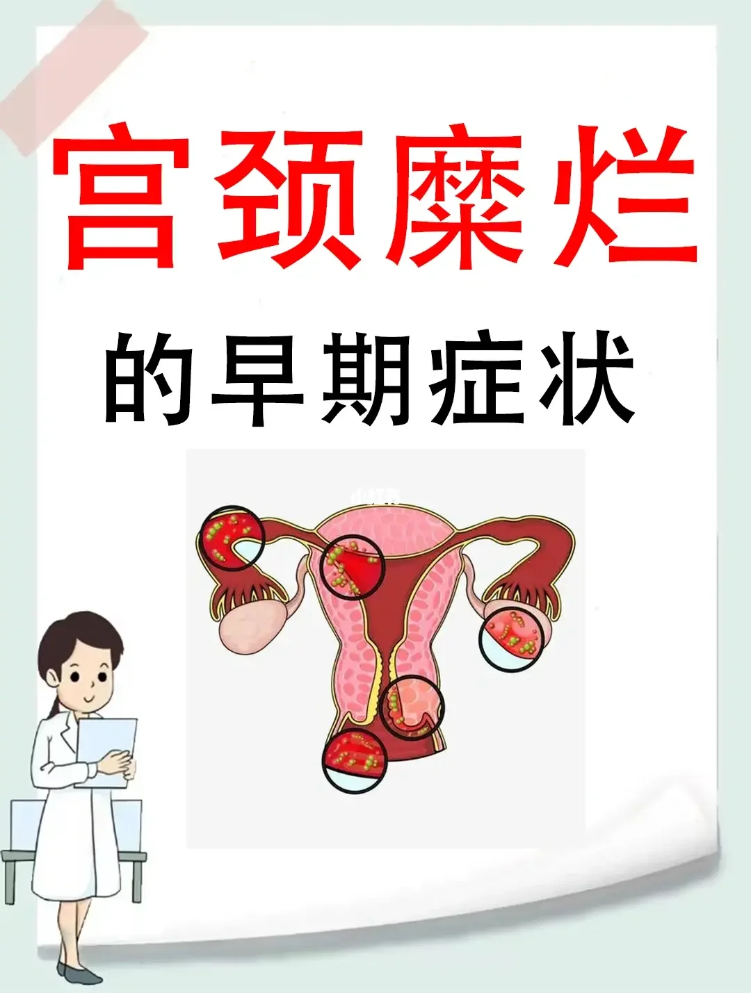轻度宫颈糜烂会自愈吗