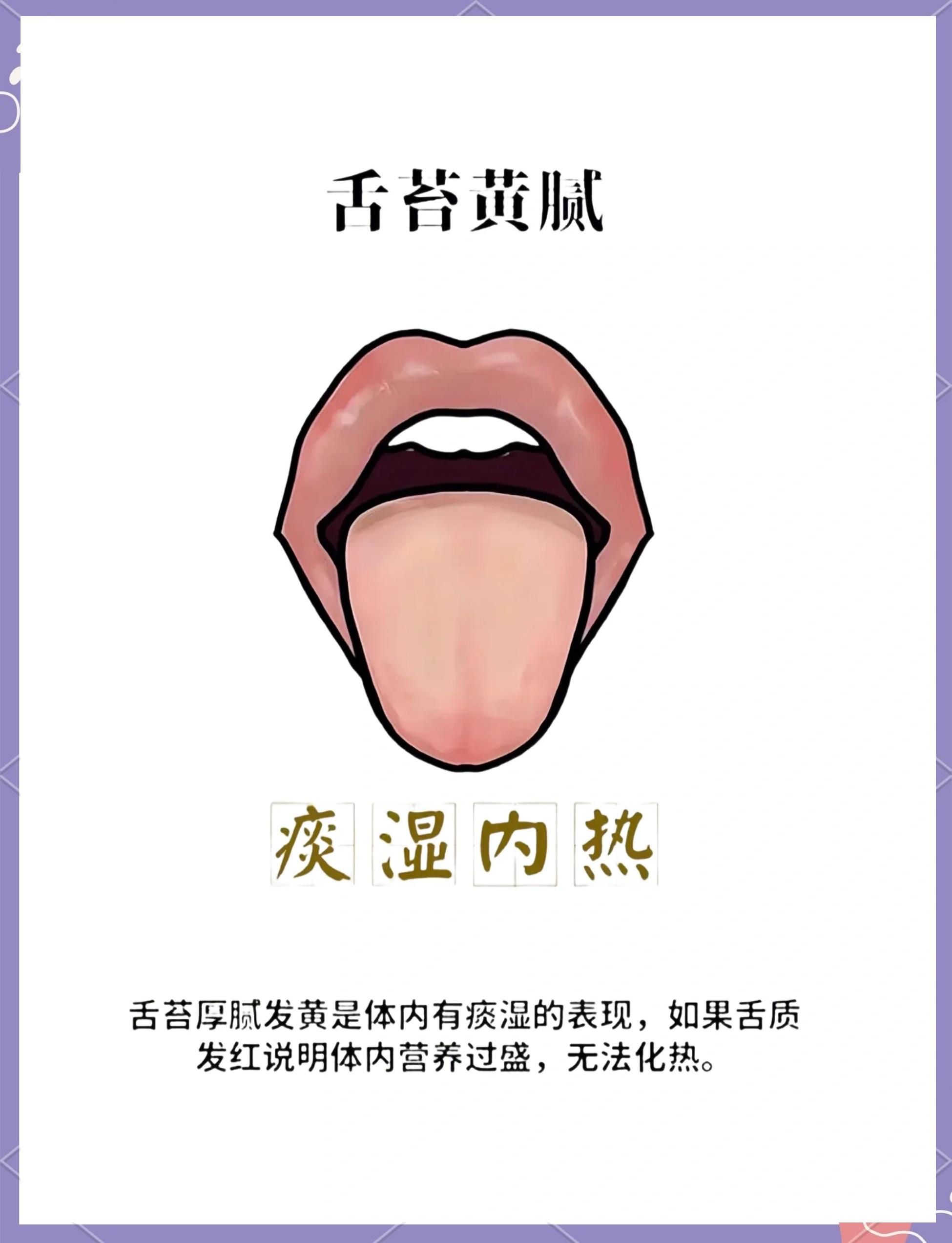 怎样判断舌苔颜色为正常