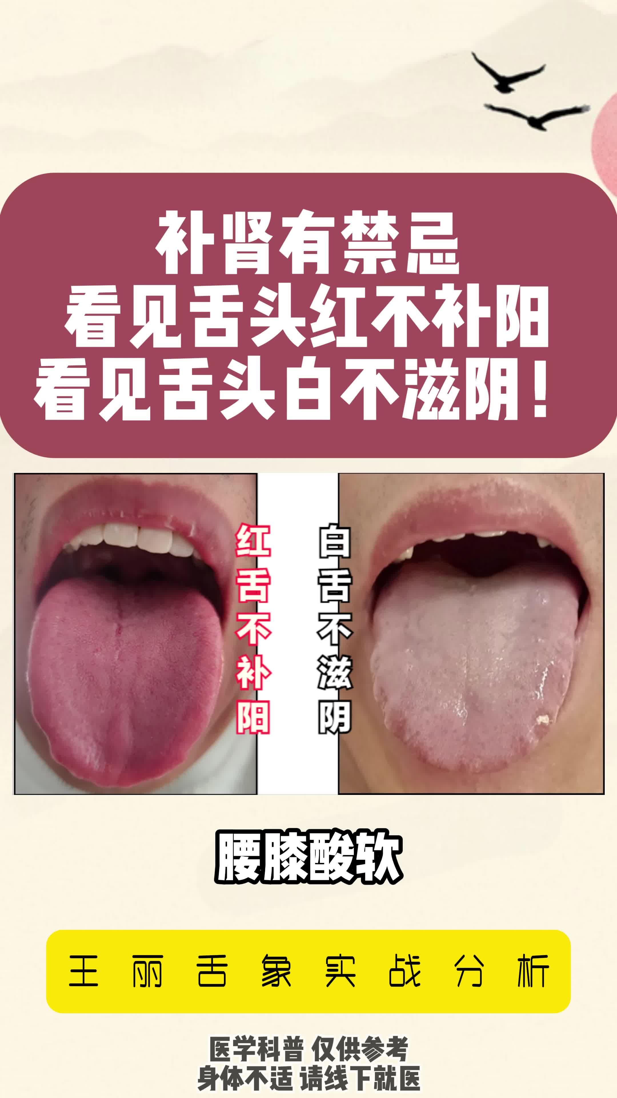 怎样判断舌苔颜色为正常